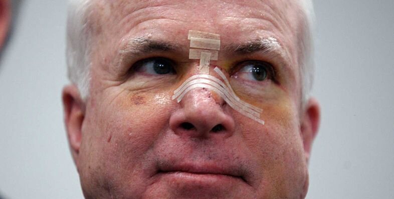 John McCain Brain Cancer